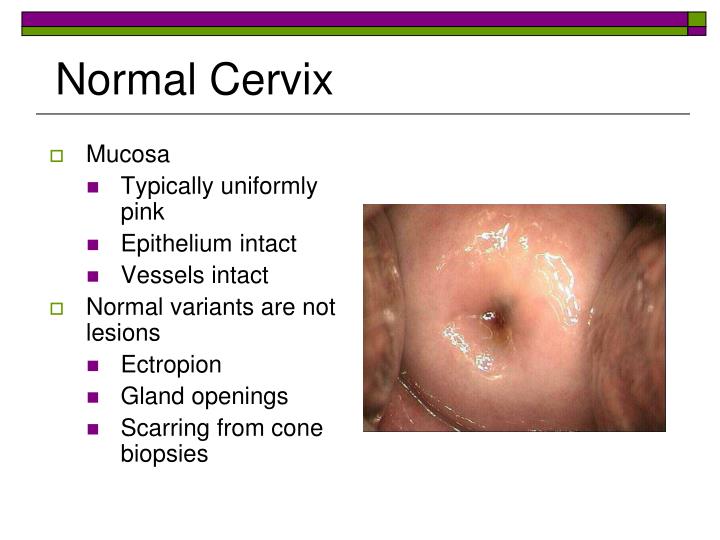 PPT Clinical Considerations PowerPoint Presentation ID 1569779 ppt-clinical-considerations-powerpoint-presentation-id-1569779