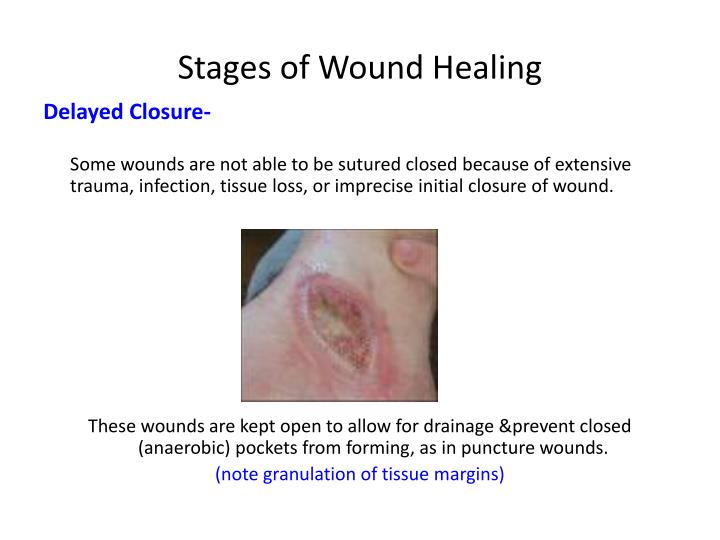 Diagnosis Of A Stages Of Wound Healing