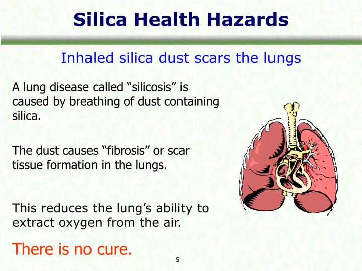 silica poisoning silica poisoning