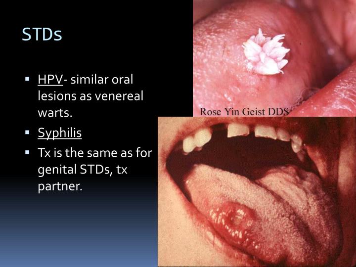 Ppt Oral Dental Emergencies Powerpoint Presentation Id1880246