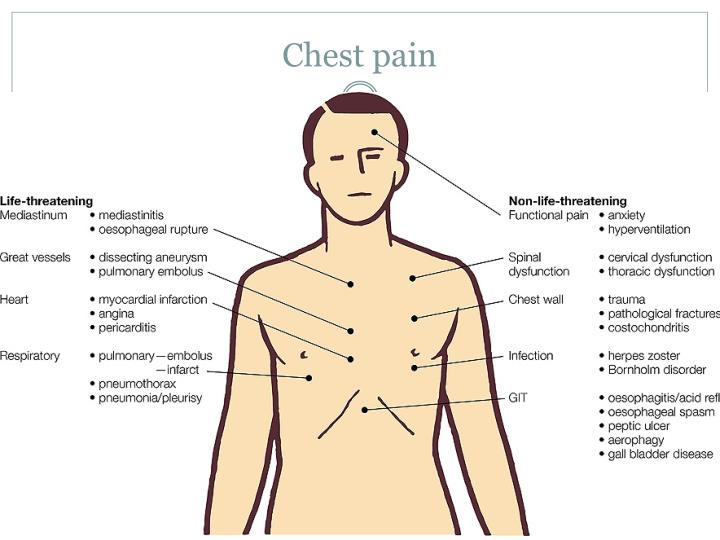 pinpoint pain in chest left side