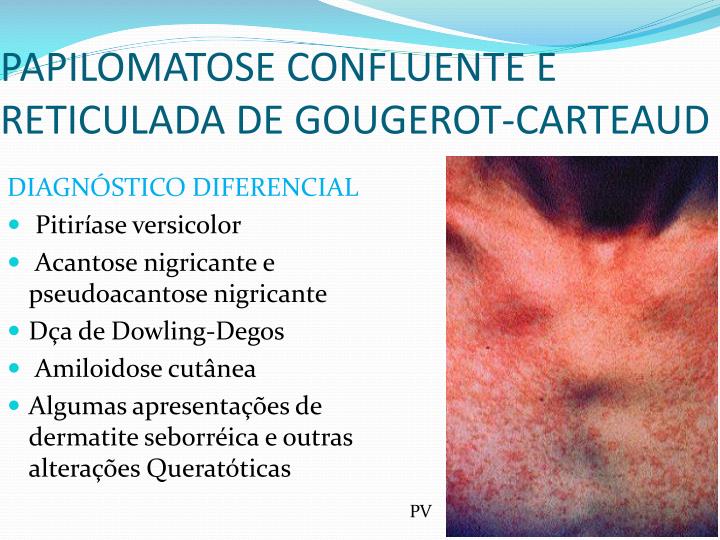 PPT - DERMATOSES QUERATÓTICAS PowerPoint Presentation - ID PPT - DERMATOSES QUERATÓTICAS PowerPoint Presentation - ID
