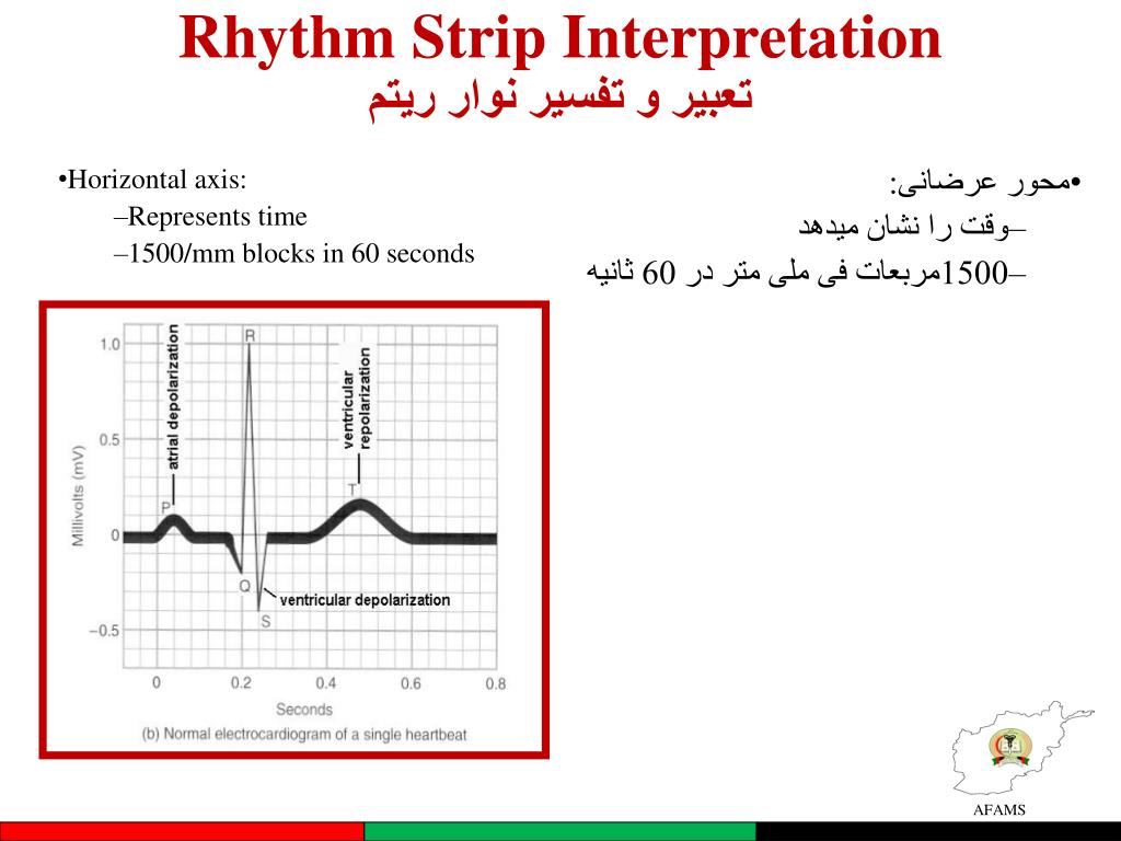 Free easy rythum strip interpretation
