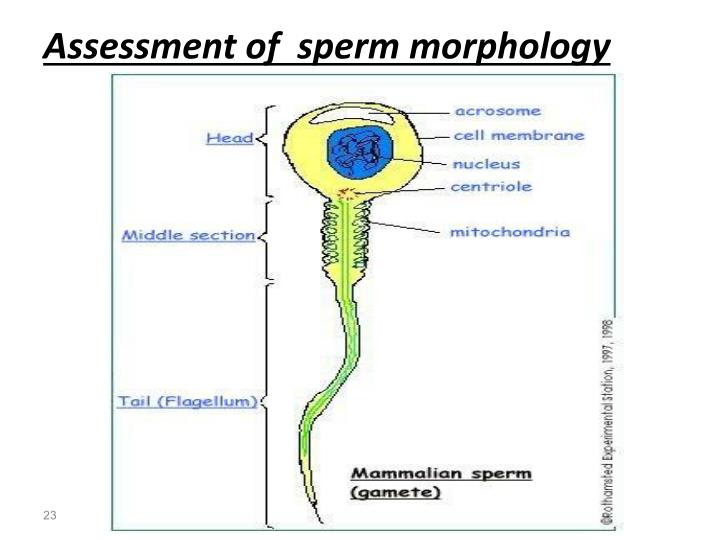 ppt-semen-analysis-powerpoint-presentation-id-1992878