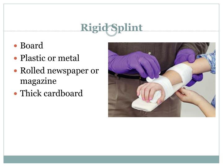 PPT Splinting PowerPoint Presentation ID2017070