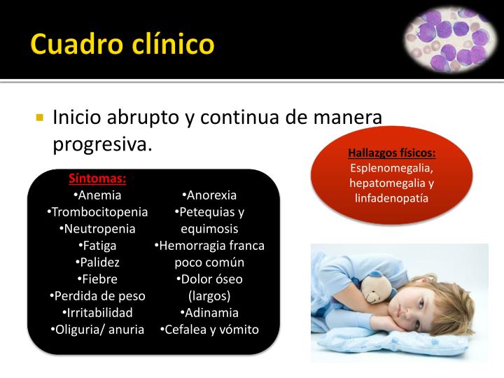 cuadro cl nico ppt leucemia linfobl 225 stica aguda lla powerpoint cuadro cl nico ppt leucemia linfobl 225 stica aguda lla powerpoint
