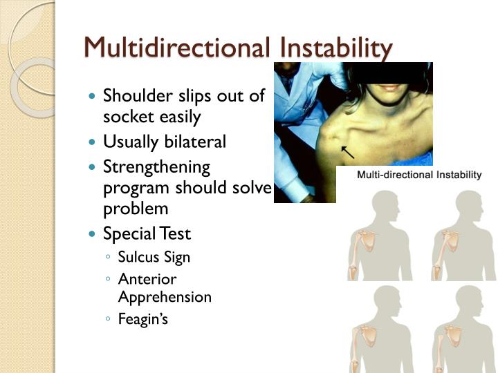 PPT Ch. 21 Shoulder Injuries PowerPoint Presentation ID2067711