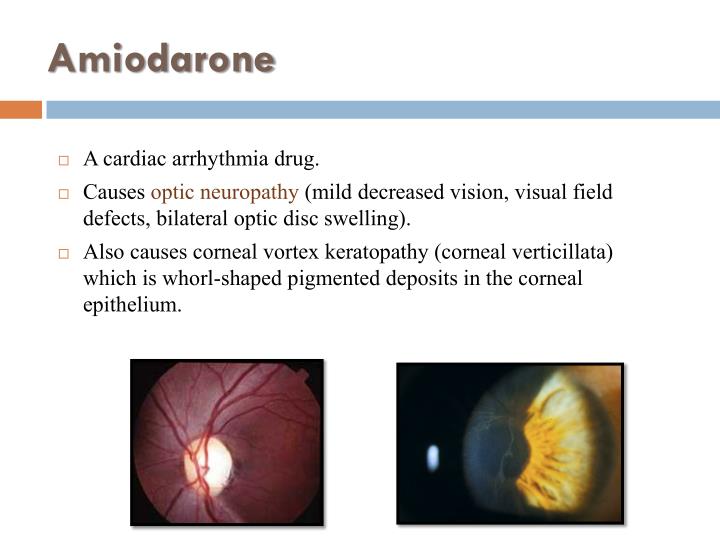 Amiodarone Side Effects Eye