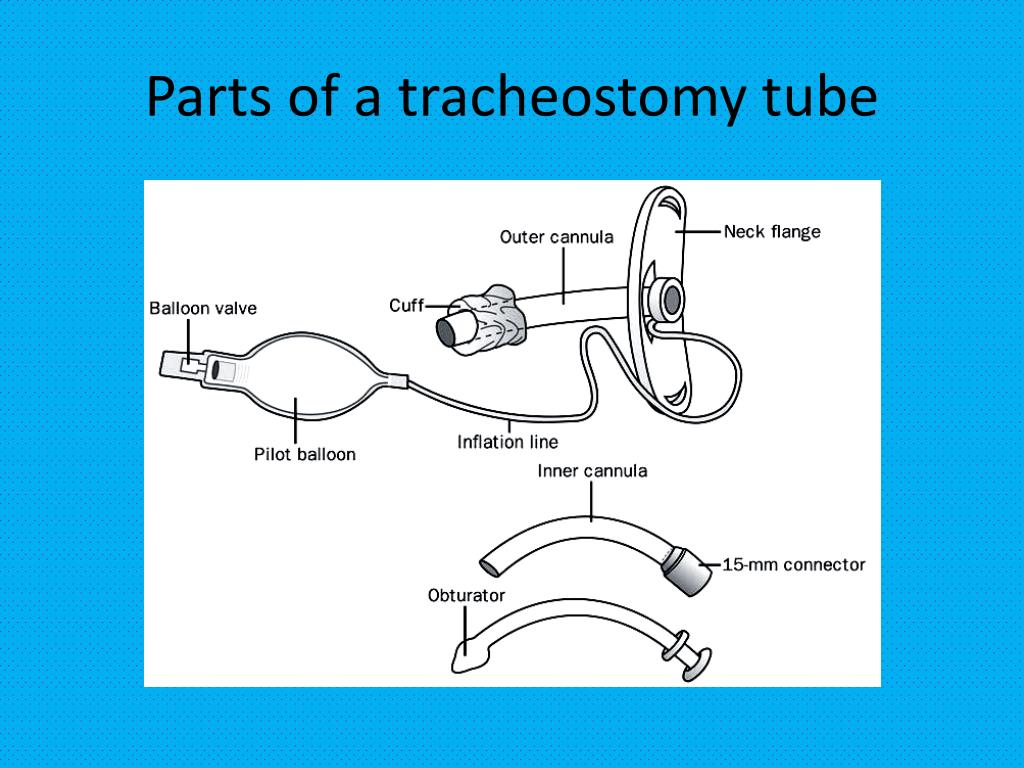Tracheostomy Tube Diagram