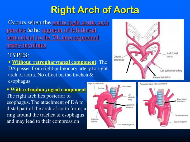 PPT - The Aortic Arches PowerPoint Presentation - ID:2090347