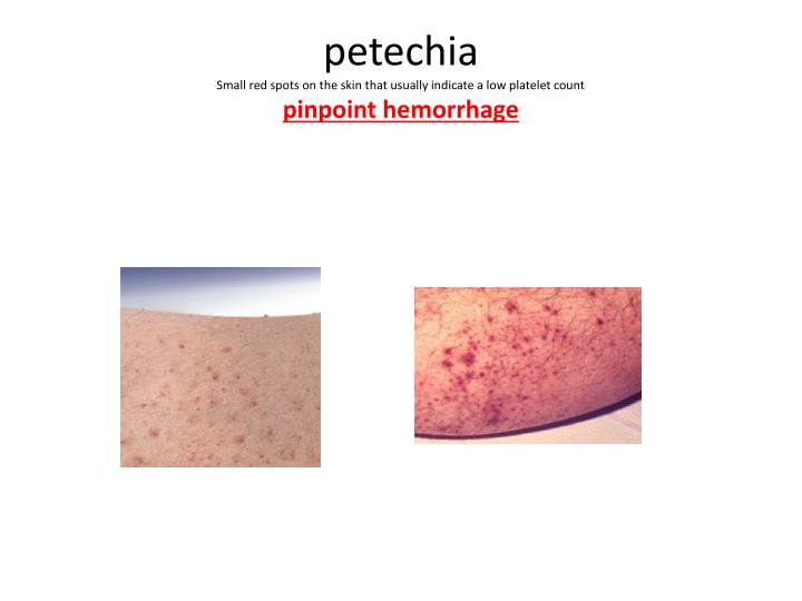 pinpoint red dots on skin cancer pinpoint red dots on skin cancer