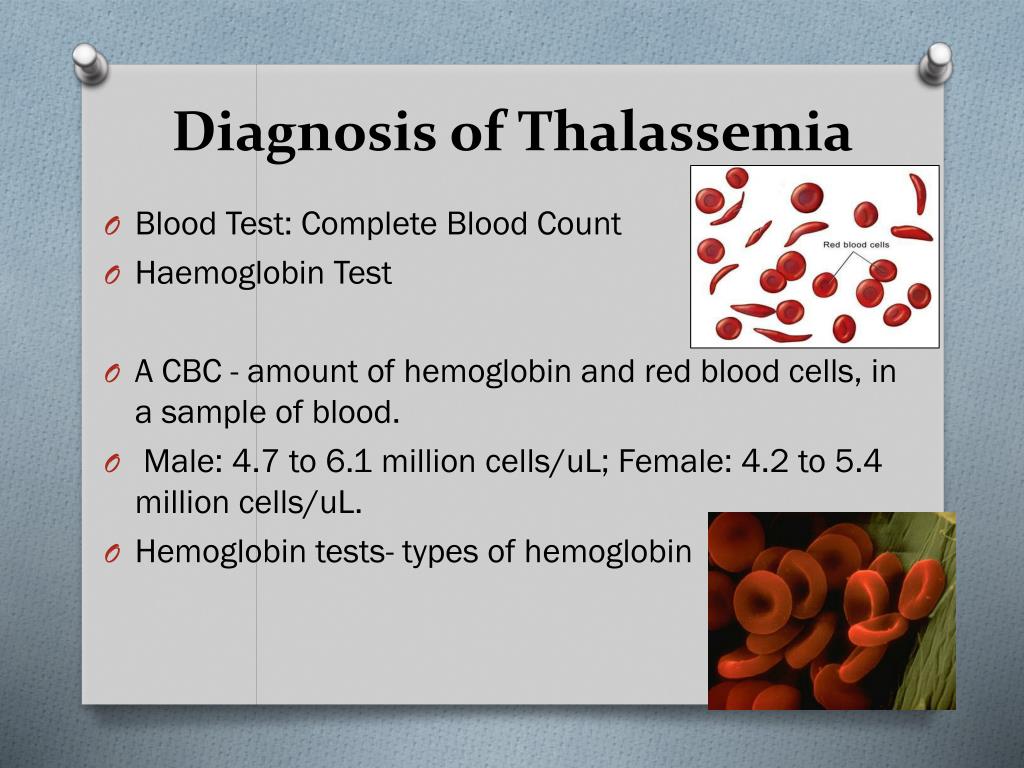 Sickle Beta Thalassemia Powerpoint Ppt Presentations Sickle Beta