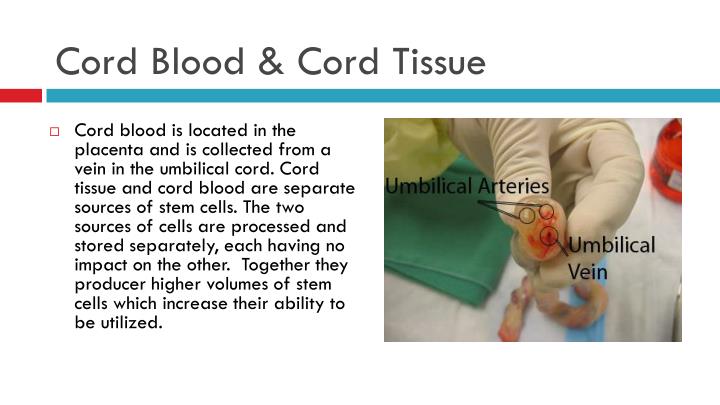 cord blood and tissue The tissue found in your baby’s umbilical cord contains a special kind of stem cell — different from cord blood stem cells these special cells are being studied. cord blood and tissue The tissue found in your baby’s umbilical cord contains a special kind of stem cell — different from cord blood stem cells these special cells are being studied.