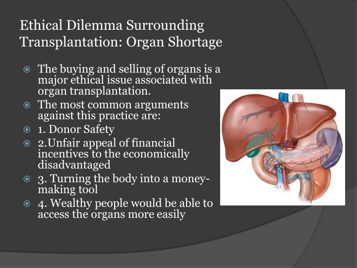 Ethical Dilemmas In Transplantation