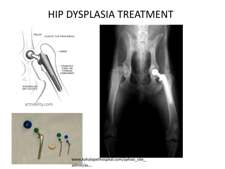 hip dysplasia surgery ppt poor conformation hip dysplasia powerpoint presentation id 2170404 hip dysplasia surgery ppt poor conformation hip dysplasia powerpoint presentation id 2170404