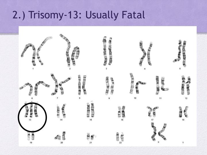 Ppt Karyotype And Genetic Disorders Powerpoint