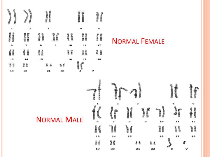 Ppt Karyotype Powerpoint Presentation Id 2171630