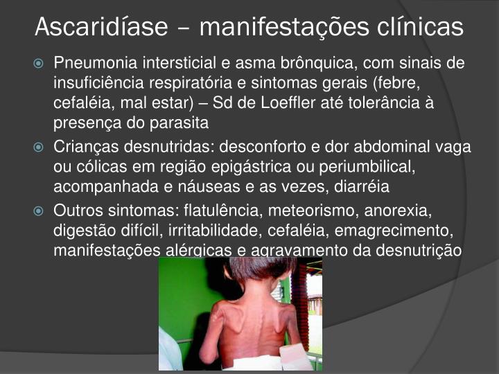 Sinais de parasitas na criança de uma ano