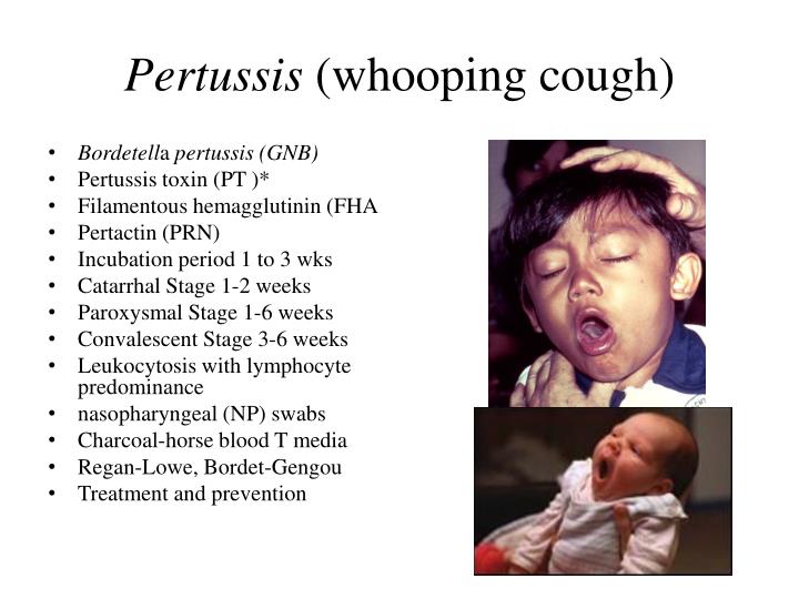 PPT  Upper Respiratory Tract Infection URTI PowerPoint Presentation