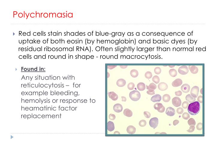 What Does Slight Polychromasia Mean PPT - Practical of Clinical Hematology PowerPoint Presentation - ID:2238955