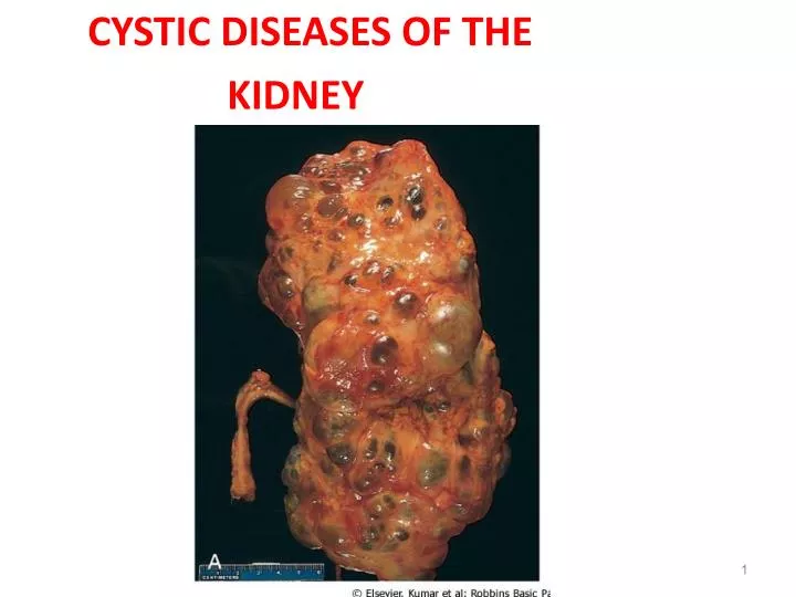 pepcid effect on kidneys