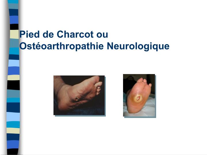 Pour le traitement de larthrose du service de poitrine