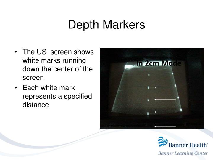 center of the screen marker center of the screen marker