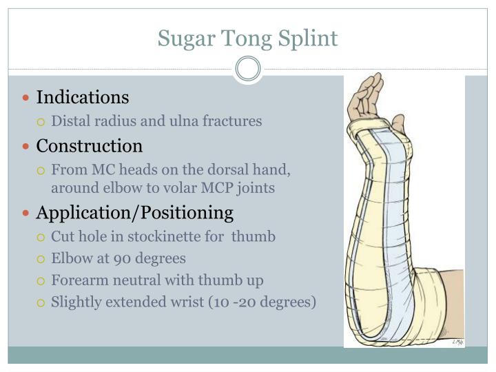 PPT Procedures Splinting PowerPoint Presentation ID2280962