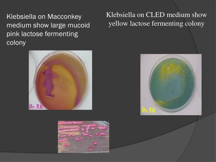 lactose fermenting gram negative rods urine lactose fermenting gram negative rods urine