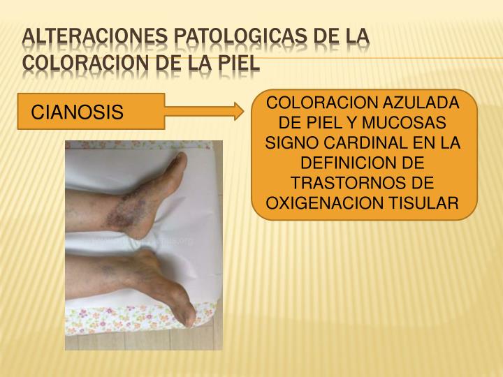 La crema de los lunares y las manchas de pigmento