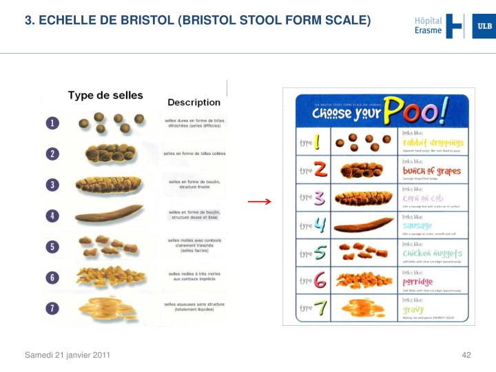 PPT Le syndrome de l’Intestin Irritable (SII) PowerPoint Presentation ID2375364