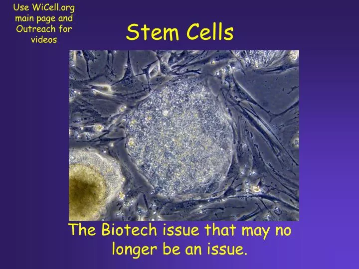an essay on stem cells Revealing the most important details for any meaningful stem cell research argumentative essay in different areas where the arguments are necessary. an essay on stem cells Revealing the most important details for any meaningful stem cell research argumentative essay in different areas where the arguments are necessary.