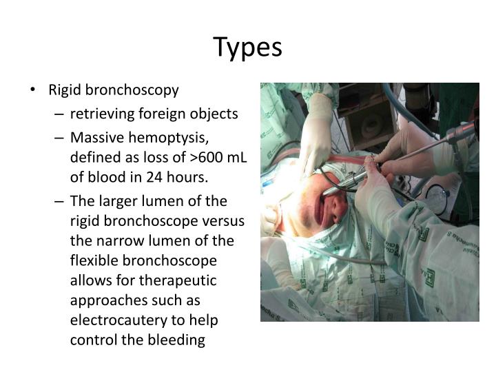 PPT Bronchoesophagoscopy PowerPoint Presentation ID 2425622 ppt-bronchoesophagoscopy-powerpoint-presentation-id-2425622