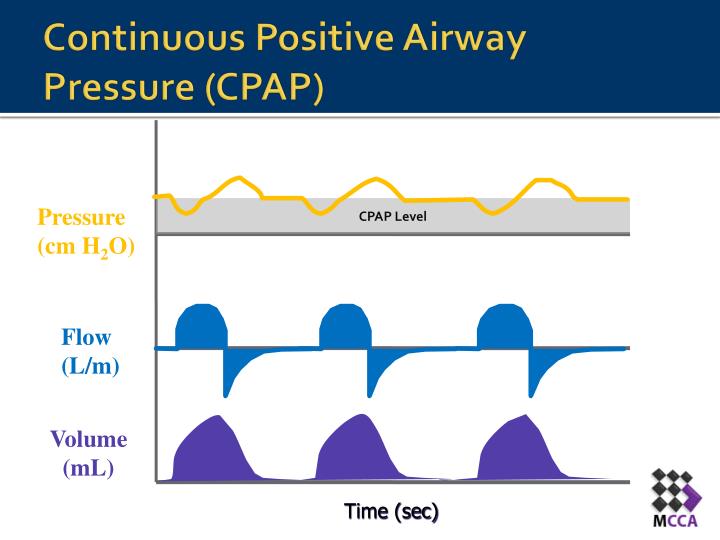 PPT - CPAP/PSV PowerPoint Presentation - ID:2462851