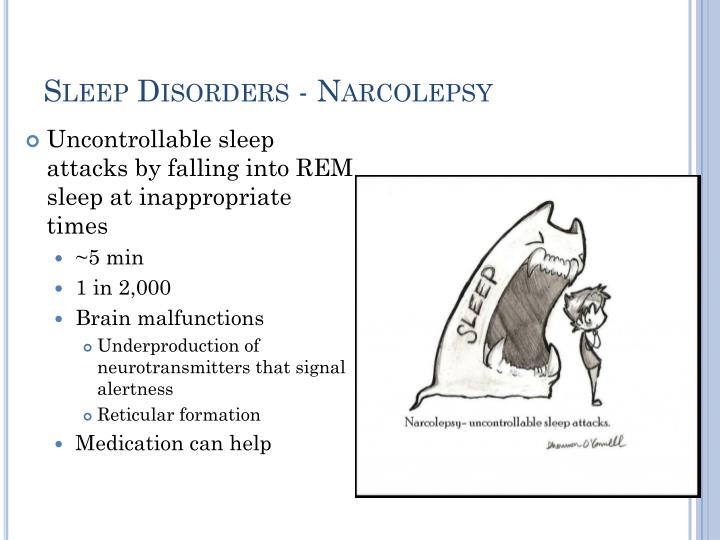 Sleep Disorders – Sleep Apnea