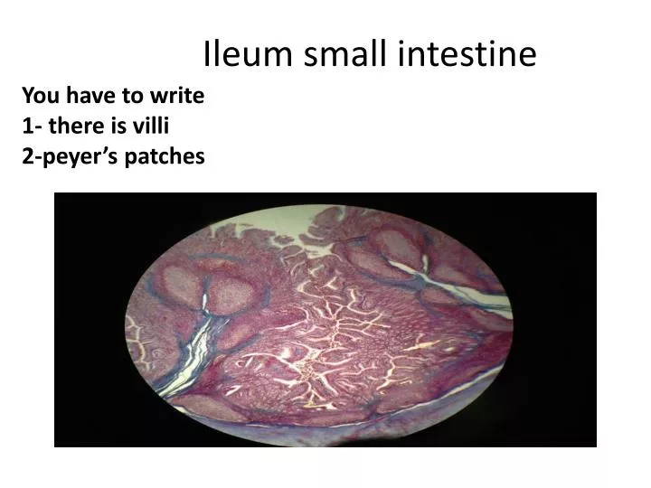 Function Of Peyer Patches In Ileum Function