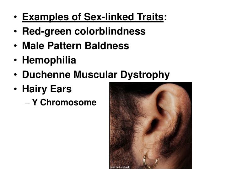 Magnificent Male pattern baldness sexlinked gene think Male pattern baldness sexlinked gene for the
