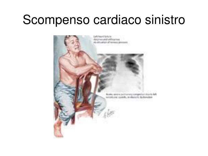 PPT - Scompenso Cardiaco Come Sindrome PowerPoint Presentation - ID:2943844