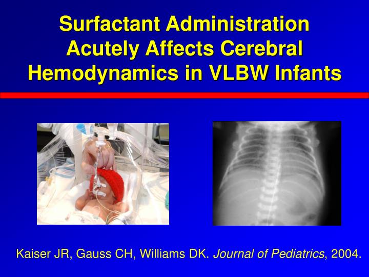 PPT Brain Injury in Premature Infants The Role of