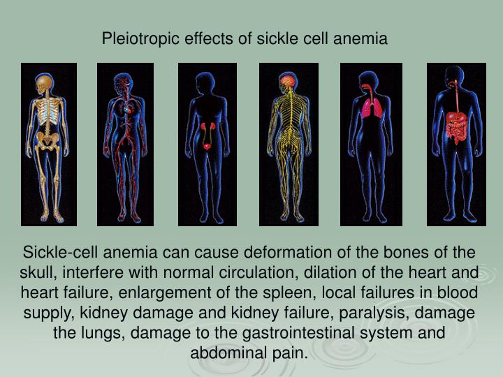 effect of sicklecell anemia in adults effect of sicklecell anemia in adults