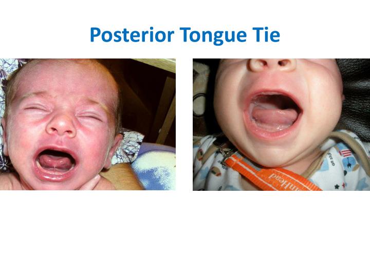 ppt-jill-rabin-m-s-ccc-slp-l-ibclc-pediatric-speech-language