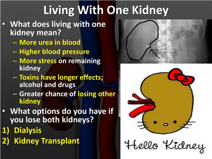 ppt-structure-of-the-kidney-powerpoint-presentation-id-3086586