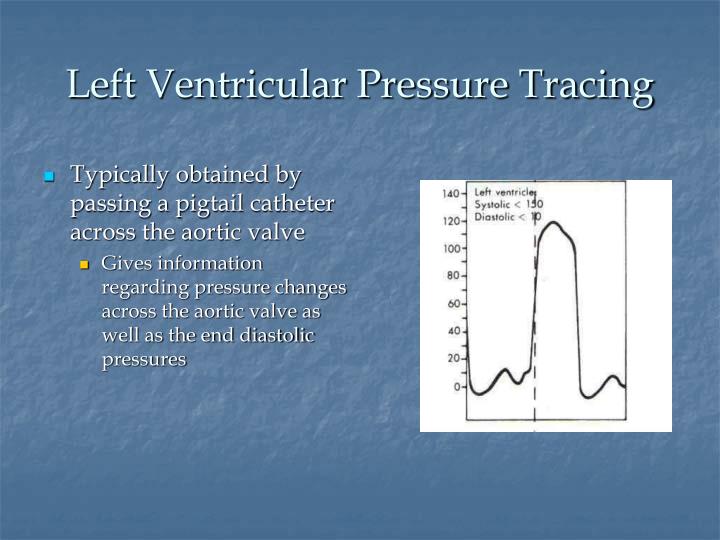 PPT - Right Heart Catheterization – basic right heart pressure tracings PowerPoint Presentation ...