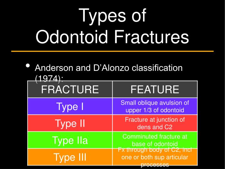 icd10 diagnosis for odontoid fracture type 2