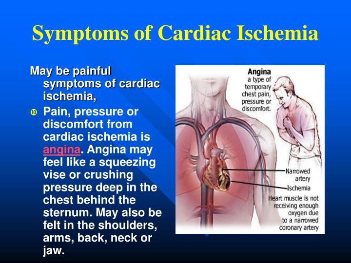 Ppt - 12 Lead Ekg 101 Powerpoint Presentation - Id:3223309