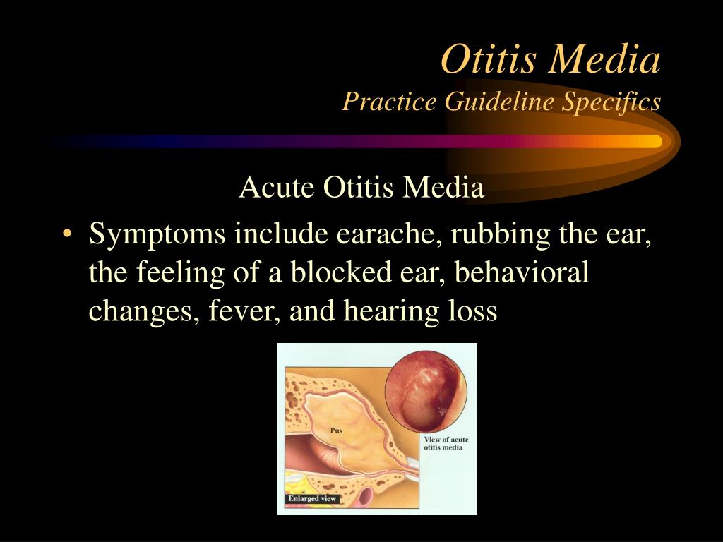 PPT Otitis Media Practice Guidelines PowerPoint Presentation Free