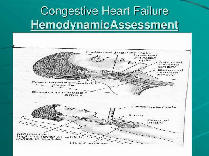 case study of patient with congestive heart failure case study of patient with congestive heart failure