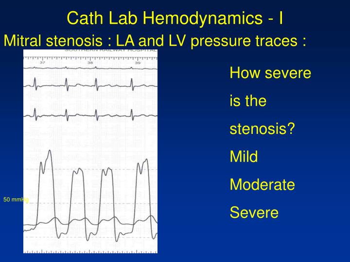 PPT - Cath-Lab Hemodynamics – I : Pressure tracings in the diseased heart PowerPoint ...