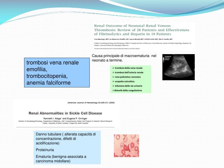 Clinica di scope varicosity prezzo di trattamento