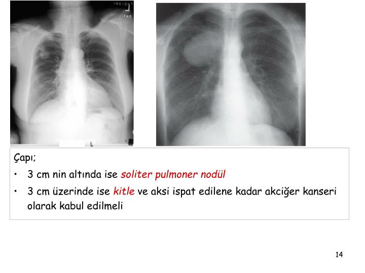 kan basıncı düşüklüğü için ipuçları